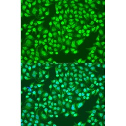 Integrin Alpha 2 (ITGA2) Antibody