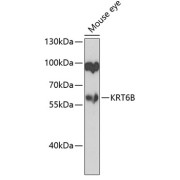 Western blot analysis of lysates from mouse eye, using KRT6B Antibody at 1/1000 dilution. Secondary antibody: HRP-conjugated Goat anti-Rabbit IgG (H+L) at 1/10000 dilution. Lysates/proteins: 25 µg per lane. Blocking buffer: 3% nonfat dry milk in TBST. Exposure time: 90s.