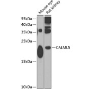 Western blot analysis of various lysates using CALml5 Antibody at 1/1000 dilution. Secondary antibody: HRP-conjugated Goat anti-Rabbit IgG (H+L) at 1/10000 dilution. Lysates/proteins: 25 µg per lane. Blocking buffer: 3% nonfat dry milk in TBST. Exposure time: 90s.