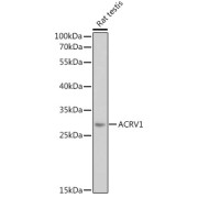 Western blot analysis of lysates from Rat testis, using ACRV1 Antibody at 1/1000 dilution. Secondary antibody: HRP-conjugated Goat anti-Rabbit IgG (H+L) at 1/10000 dilution. Lysates/proteins: 25 µg per lane. Blocking buffer: 3% nonfat dry milk in TBST. Exposure time: 30s.