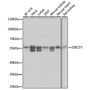 Western blot analysis of various lysates using OXCT1 Antibody at 1/3000 dilution. Secondary antibody: HRP-conjugated Goat anti-Rabbit IgG (H+L) at 1/10000 dilution. Lysates/proteins: 25 µg per lane. Blocking buffer: 3% nonfat dry milk in TBST. Exposure time: 1s.