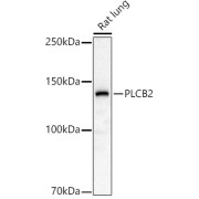 Western blot analysis of lysates from Rat lung, using PLCB2 Antibody at 1/1000 dilution. Secondary antibody: HRP-conjugated Goat anti-Rabbit IgG (H+L) at 1/10000 dilution. Lysates/proteins: 25 µg per lane. Blocking buffer: 3% nonfat dry milk in TBST. Exposure time: 180s.