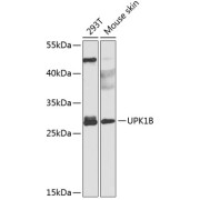 Western blot analysis of various lysates using UPK1B Antibody at 1/1000 dilution. Secondary antibody: HRP-conjugated Goat anti-Rabbit IgG (H+L) at 1/10000 dilution. Lysates/proteins: 25 µg per lane. Blocking buffer: 3% nonfat dry milk in TBST. Exposure time: 90s.