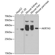 Western blot analysis of various lysates using AKR7A3 Antibody at 1/1000 dilution. Secondary antibody: HRP-conjugated Goat anti-Rabbit IgG (H+L) at 1/10000 dilution. Lysates/proteins: 25 µg per lane. Blocking buffer: 3% nonfat dry milk in TBST. Exposure time: 30s.