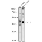 Western blot analysis of various lysates using SYT11 Antibody at 1/600 dilution. Secondary antibody: HRP-conjugated Goat anti-Rabbit IgG (H+L) at 1/10000 dilution. Lysates/proteins: 25 µg per lane. Blocking buffer: 3% nonfat dry milk in TBST. Exposure time: 20s.