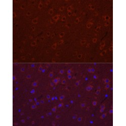 Synaptotagmin 11 (SYT11) Antibody