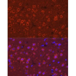 Synaptotagmin 11 (SYT11) Antibody