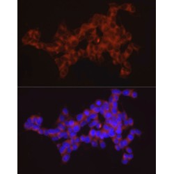 Synaptotagmin 11 (SYT11) Antibody