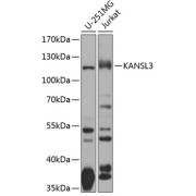 Western blot analysis of various lysates using KANSL3 Antibody at 1/1000 dilution. Secondary antibody: HRP-conjugated Goat anti-Rabbit IgG (H+L) at 1/10000 dilution. Lysates/proteins: 25 µg per lane. Blocking buffer: 3% nonfat dry milk in TBST. Exposure time: 15s.