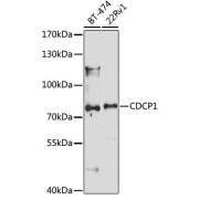 Western blot analysis of various lysates using CDCP1 Antibody at 1/1000 dilution. Secondary antibody: HRP-conjugated Goat anti-Rabbit IgG (H+L) at 1/10000 dilution. Lysates/proteins: 25 µg per lane. Blocking buffer: 3% nonfat dry milk in TBST. Exposure time: 90s.