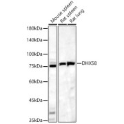 Western blot analysis of various lysates, using DHX58 Antibody at 1/9000 dilution. Secondary antibody: HRP-conjugated Goat anti-Rabbit IgG (H+L) at 1/10000 dilution. Lysates/proteins: 25 µg per lane. Blocking buffer: 3% nonfat dry milk in TBST. Exposure time: 90s.