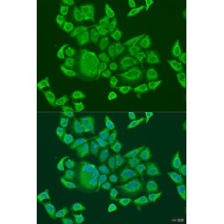 DExH-Box Helicase 58 (DHX58) Antibody