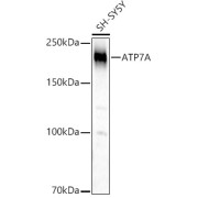 Western blot analysis of lysates from Rat lung using ATP7A Antibody at 1/1000 dilution. Secondary antibody: HRP-conjugated Goat anti-Rabbit IgG (H+L) at 1/10000 dilution. Lysates/proteins: 25 µg per lane. Blocking buffer: 3% nonfat dry milk in TBST. Exposure time: 60s.