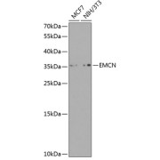 Western blot analysis of various lysates using Endomucin Antibody at 1/1000 dilution. Secondary antibody: HRP-conjugated Goat anti-Rabbit IgG (H+L) at 1/10000 dilution. Lysates/proteins: 25 µg per lane. Blocking buffer: 3% nonfat dry milk in TBST. Exposure time: 90s.