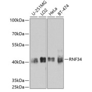 Western blot analysis of various lysates using RNF34 Antibody at 1/1000 dilution. Secondary antibody: HRP-conjugated Goat anti-Rabbit IgG (H+L) at 1/10000 dilution. Lysates/proteins: 25 µg per lane. Blocking buffer: 3% nonfat dry milk in TBST. Exposure time: 90s.