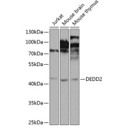 Western blot analysis of various lysates using DEDD2 Antibody at 1/1000 dilution. Secondary antibody: HRP-conjugated Goat anti-Rabbit IgG (H+L) at 1/10000 dilution. Lysates/proteins: 25 µg per lane. Blocking buffer: 3% nonfat dry milk in TBST. Exposure time: 5s.