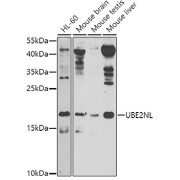 Western blot analysis of various lysates using UBE2NL Antibody at 1/1000 dilution. Secondary antibody: HRP-conjugated Goat anti-Rabbit IgG (H+L) at 1/10000 dilution. Lysates/proteins: 25 µg per lane. Blocking buffer: 3% nonfat dry milk in TBST. Exposure time: 60s.