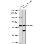 Western blot analysis of various lysates using RARS2 Antibody at 1/1000 dilution. Secondary antibody: HRP-conjugated Goat anti-Rabbit IgG (H+L) at 1/10000 dilution. Lysates/proteins: 25 µg per lane. Blocking buffer: 3% nonfat dry milk in TBST. Exposure time: 90s.