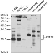 Western blot analysis of various lysates using CSRP2 Antibody at 1/1000 dilution. Secondary antibody: HRP-conjugated Goat anti-Rabbit IgG (H+L) at 1/10000 dilution. Lysates/proteins: 25 µg per lane. Blocking buffer: 3% nonfat dry milk in TBST. Exposure time: 90s.