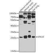 Western blot analysis of various lysates using STK19 Antibody at 1/1000 dilution. Secondary antibody: HRP-conjugated Goat anti-Rabbit IgG (H+L) at 1/10000 dilution. Lysates/proteins: 25 µg per lane. Blocking buffer: 3% nonfat dry milk in TBST. Exposure time: 90s.