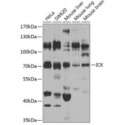 Western blot analysis of various lysates using ICK Antibody at 1/1000 dilution. Secondary antibody: HRP-conjugated Goat anti-Rabbit IgG (H+L) at 1/10000 dilution. Lysates/proteins: 25 µg per lane. Blocking buffer: 3% nonfat dry milk in TBST. Exposure time: 30s.