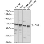 Western blot analysis of various lysates using CLK2 Antibody at 1/1000 dilution. Secondary antibody: HRP-conjugated Goat anti-Rabbit IgG (H+L) at 1/10000 dilution. Lysates/proteins: 25 µg per lane. Blocking buffer: 3% nonfat dry milk in TBST. Exposure time: 30s.