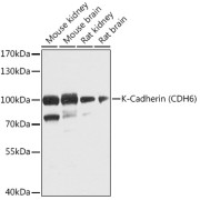 Western blot analysis of various lysates using K-Cadherin (CDH6) Antibody at 1/1000 dilution. Secondary antibody: HRP-conjugated Goat anti-Rabbit IgG (H+L) at 1/10000 dilution. Lysates/proteins: 25 µg per lane. Blocking buffer: 3% nonfat dry milk in TBST. Exposure time: 90s.