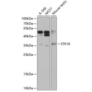 Western blot analysis of various lysates using STK16 Antibody at 1/1000 dilution. Secondary antibody: HRP-conjugated Goat anti-Rabbit IgG (H+L) at 1/10000 dilution. Lysates/proteins: 25 µg per lane. Blocking buffer: 3% nonfat dry milk in TBST. Exposure time: 15s.