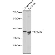 Western blot analysis of various lysates using RNF219 Antibody at 1/1000 dilution. Secondary antibody: HRP-conjugated Goat anti-Rabbit IgG (H+L) at 1/10000 dilution. Lysates/proteins: 25 µg per lane. Blocking buffer: 3% nonfat dry milk in TBST. Exposure time: 90s.