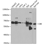 Western blot analysis of various lysates using C8B Antibody at 1/1000 dilution. Secondary antibody: HRP-conjugated Goat anti-Rabbit IgG (H+L) at 1/10000 dilution. Lysates/proteins: 25 µg per lane. Blocking buffer: 3% nonfat dry milk in TBST. Exposure time: 90s.