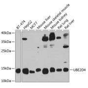 Western blot analysis of various lysates using UBE2D4 Antibody at 1/1000 dilution. Secondary antibody: HRP-conjugated Goat anti-Rabbit IgG (H+L) at 1/10000 dilution. Lysates/proteins: 25 µg per lane. Blocking buffer: 3% nonfat dry milk in TBST. Exposure time: 30s.