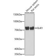 Western blot analysis of various lysates using IL4I1 Antibody at 1/1000 dilution. Secondary antibody: HRP-conjugated Goat anti-Rabbit IgG (H+L) at 1/10000 dilution. Lysates/proteins: 25 µg per lane. Blocking buffer: 3% nonfat dry milk in TBST. Exposure time: 10s.