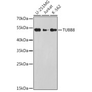 Western blot analysis of various lysates using TUBB8 Antibody at 1/1000 dilution. Secondary antibody: HRP-conjugated Goat anti-Rabbit IgG (H+L) at 1/10000 dilution. Lysates/proteins: 25 µg per lane. Blocking buffer: 3% nonfat dry milk in TBST. Exposure time: 90s.