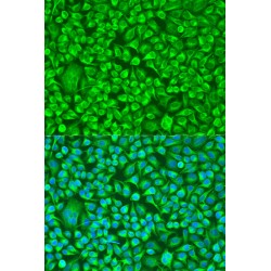 Tubulin Beta-8 Chain (TUBB8) Antibody