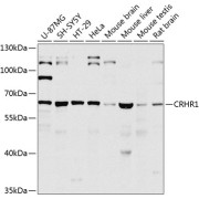 Western blot analysis of various lysates using CRHR1 Antibody at 1/1000 dilution. Secondary antibody: HRP-conjugated Goat anti-Rabbit IgG (H+L) at 1/10000 dilution. Lysates/proteins: 25 µg per lane. Blocking buffer: 3% nonfat dry milk in TBST. Exposure time: 20s.