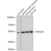 Western blot analysis of various lysates using FAM20A Antibody at 1/1000 dilution. Secondary antibody: HRP-conjugated Goat anti-Rabbit IgG (H+L) at 1/10000 dilution. Lysates/proteins: 25 µg per lane. Blocking buffer: 3% nonfat dry milk in TBST. Exposure time: 5s.