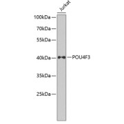 Western blot analysis of lysates from Jurkat cells, using POU4F3 Antibody at 1/1000 dilution. Secondary antibody: HRP-conjugated Goat anti-Rabbit IgG (H+L) at 1/10000 dilution. Lysates/proteins: 25 µg per lane. Blocking buffer: 3% nonfat dry milk in TBST. Exposure time: 90s.