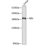 Western blot analysis of lysates from Jurkat cells, using NIN Antibody at 1/1000 dilution. Secondary antibody: HRP-conjugated Goat anti-Rabbit IgG (H+L) at 1/10000 dilution. Lysates/proteins: 25 µg per lane. Blocking buffer: 3% nonfat dry milk in TBST. Exposure time: 90s.