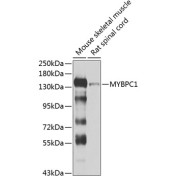 Western blot analysis of various lysates using MYBPC1 Antibody at 1/1000 dilution. Secondary antibody: HRP-conjugated Goat anti-Rabbit IgG (H+L) at 1/10000 dilution. Lysates/proteins: 25 µg per lane. Blocking buffer: 3% nonfat dry milk in TBST. Exposure time: 10s.