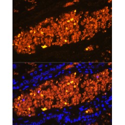 Hemoglobin subunit alpha 2 Antibody