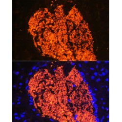 Hemoglobin subunit alpha 2 Antibody