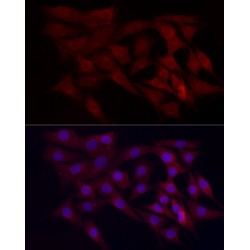 WD Repeat Domain Phosphoinositide-Interacting Protein 4 / WIPI-4 (WDR45) Antibody