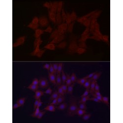 WD Repeat Domain Phosphoinositide-Interacting Protein 4 / WIPI-4 (WDR45) Antibody