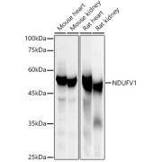 Western blot analysis of various lysates using NDUFV1 Antibody at 1/500 dilution. Secondary antibody: HRP-conjugated Goat anti-Rabbit IgG (H+L) at 1/10000 dilution. Lysates/proteins: 25 µg per lane. Blocking buffer: 3% nonfat dry milk in TBST. Exposure time: 10s.
