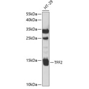 Western blot analysis of lysates from HT-29 cells, using TFF2 Antibody at 1/1000 dilution. Secondary antibody: HRP-conjugated Goat anti-Rabbit IgG (H+L) at 1/10000 dilution. Lysates/proteins: 25 µg per lane. Blocking buffer: 3% nonfat dry milk in TBST. Exposure time: 60s.