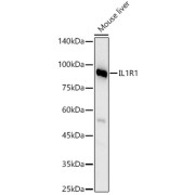 Western blot analysis of lysates from Mouse liver, using IL1R1 Antibody at 1/600 dilution. Secondary antibody: HRP-conjugated Goat anti-Rabbit IgG (H+L) at 1/10000 dilution. Lysates/proteins: 25 µg per lane. Blocking buffer: 3% nonfat dry milk in TBST. Exposure time: 60s.