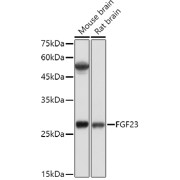 Western blot analysis of various lysates using FGF23 Antibody at 1/500 dilution. Secondary antibody: HRP-conjugated Goat anti-Rabbit IgG (H+L) at 1/10000 dilution. Lysates/proteins: 25 µg per lane. Blocking buffer: 3% nonfat dry milk in TBST. Exposure time: 10s.