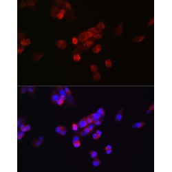 Fibroblast Growth Factor 23 (FGF23) Antibody