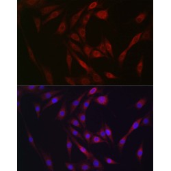 Fibroblast Growth Factor 23 (FGF23) Antibody