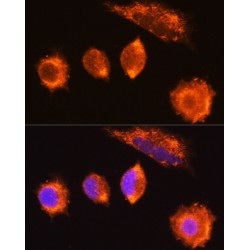 Mannosyl (Alpha-1,3-)-Glycoprotein Beta-1,2-N-Acetylglucosaminyltransferase (MGAT1) Antibody